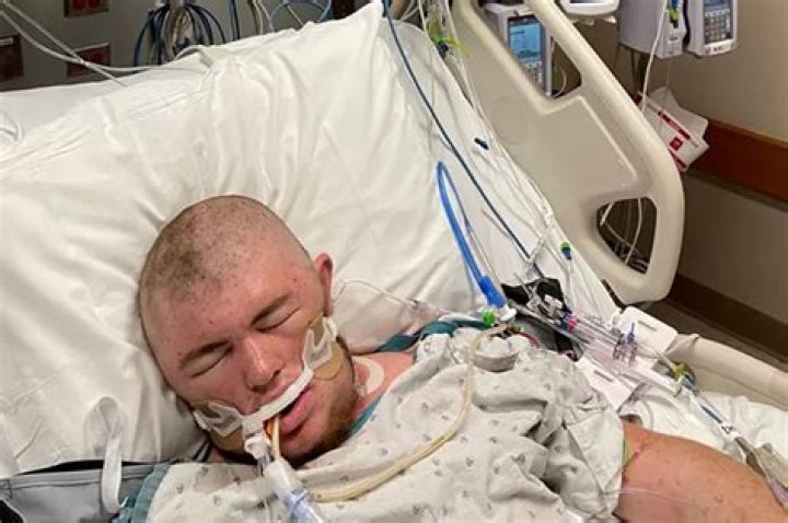 
20, Austin Bellamy, was Stung by bees 20,000 times and swallowed 30 of them 