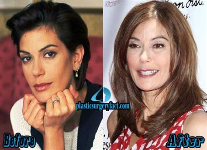 
Teri Hatcher Before Face Lift: All Things We Know About Her Plastic Surgery 
